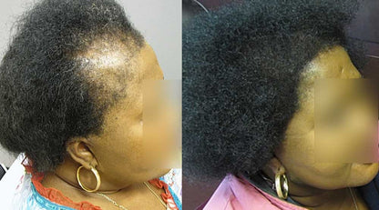 Before and after results using Pure Growth Formula shampoo and conditioner for natural hair growth.