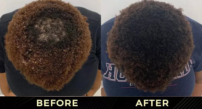 Before and after results of Pure Growth Formula on natural hair.