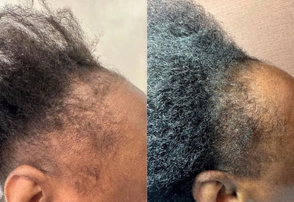 Before and after results using Pure Growth Formula on natural hair.