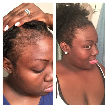 African-American woman showcasing hair growth before and after using Pure Growth Formula shampoo and conditioner.